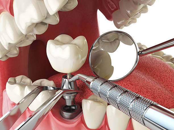 Best Urgent Tooth Repair  in Demopolis, AL